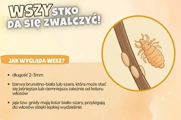 Wszawica pod lupą sanepidu – jak rozpoznać wesz i gnidy?