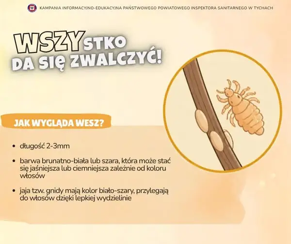 Wszawica pod lupą sanepidu – jak rozpoznać wesz i gnidy?